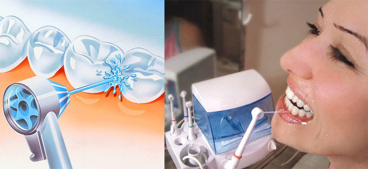may-tam-nuoc Top 5 máy tăm nước chất lượng số 1 được nha khoa xác nhận an toàn 1