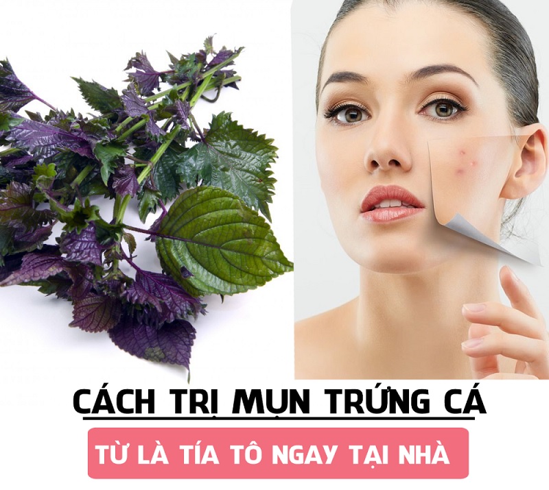 Tác dụng của lá tía tô với bà bầu trong việc trị mụn an toàn Tác dụng của lá tía tô với bà bầu trong việc trị mụn an toàn