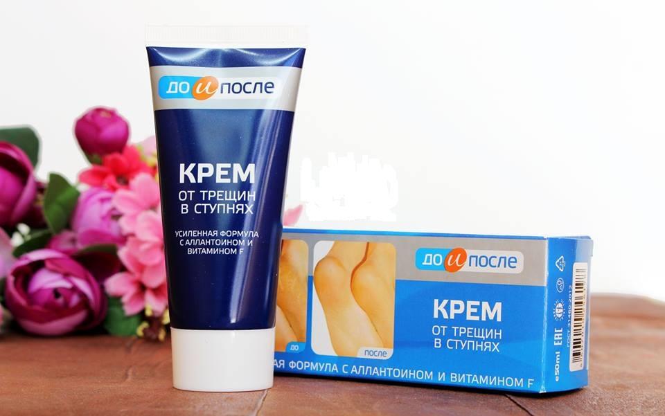 Hướng dẫn chọn kem trị nứt gót chân tốt Hướng dẫn chọn kem trị nứt gót chân tốt