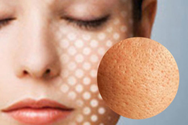 Lỗ chân lông là gì? Lỗ chân lông là gì?