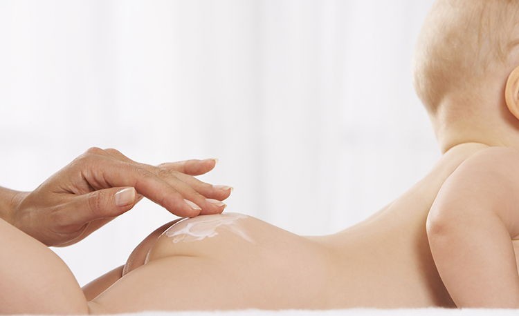 Sử dụng kem chống hăm thế nào là đúng cách Sử dụng kem chống hăm thế nào là đúng cách