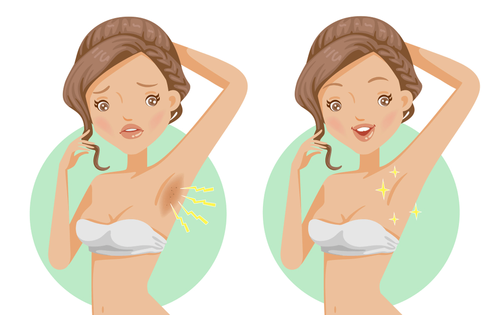 Cách sử dụng kem trị thâm nách Cách sử dụng kem trị thâm nách