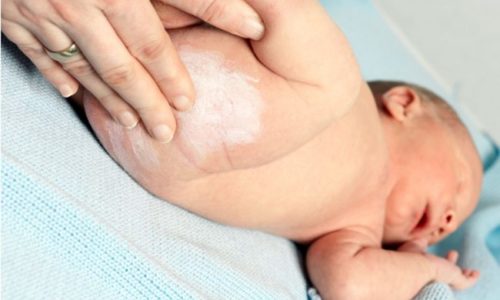 Cách chữa hăm cho trẻ sơ sinh an toàn nhất