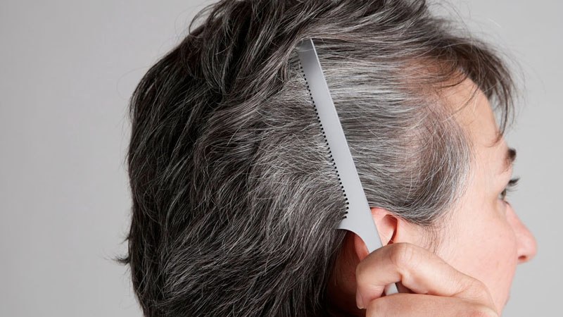 Nguyên nhân gây tóc bạc sớm